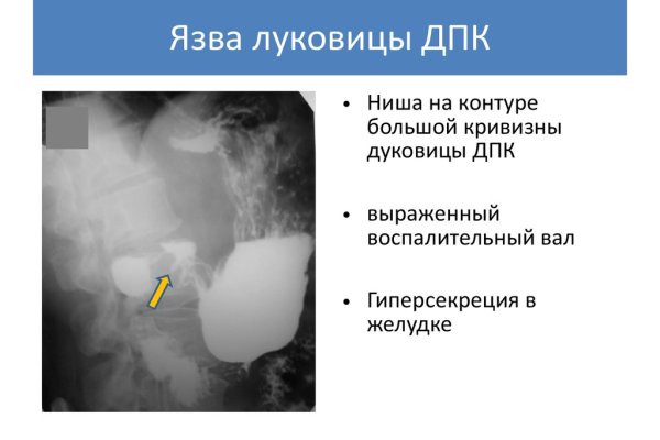 Кракен тор